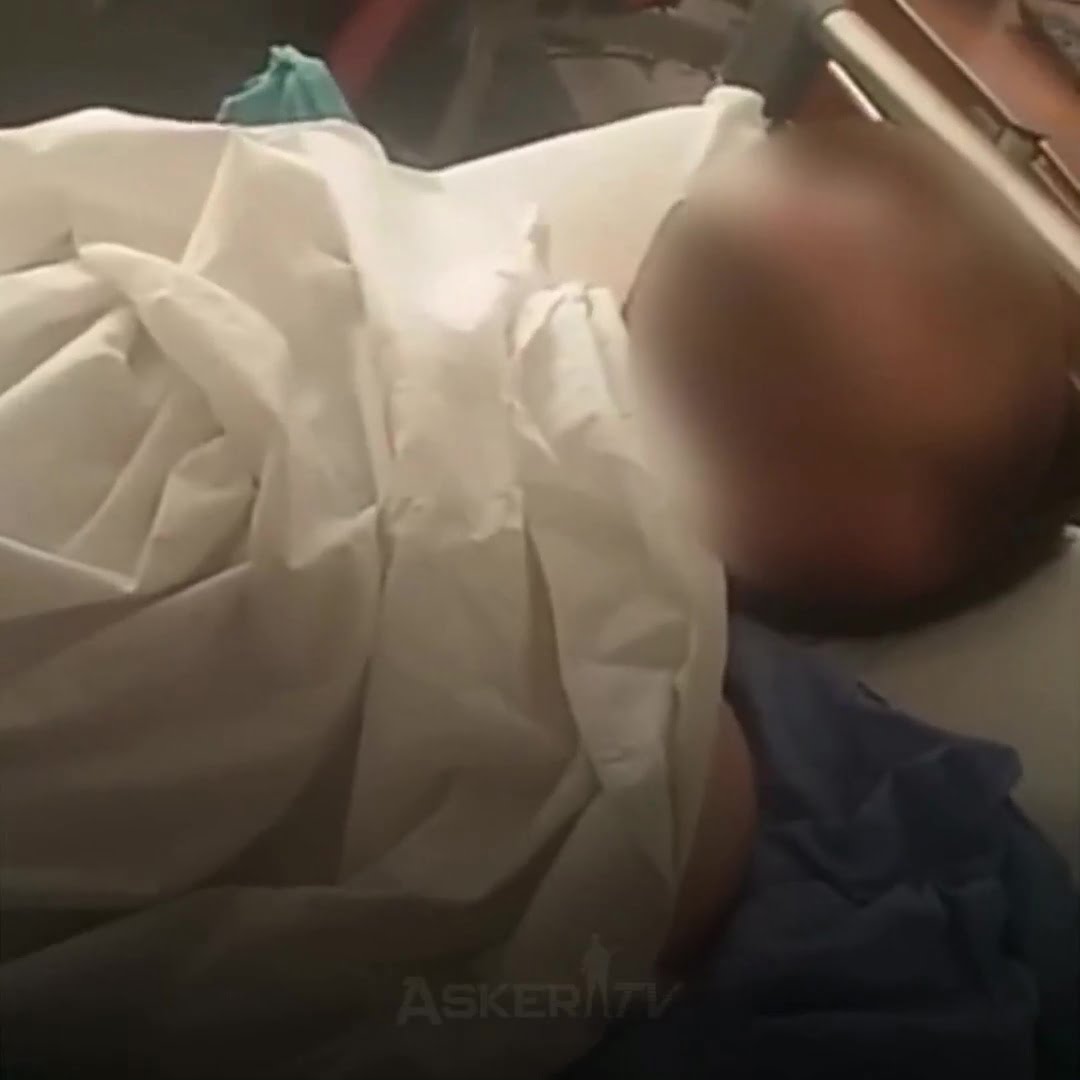 ameliyattan-cikan-pohe-narkozun-etkisi